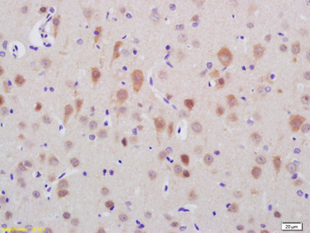 TTC21B Rabbit Polyclonal Antibody