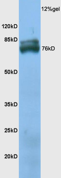 TXLNB Rabbit Polyclonal Antibody