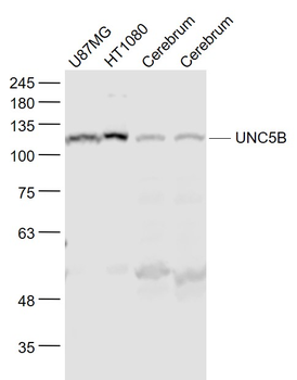 UNC5B Rabbit Polyclonal Antibody