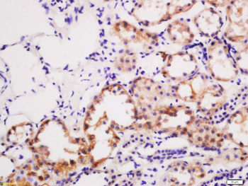 SLC22A12 Rabbit Polyclonal Antibody