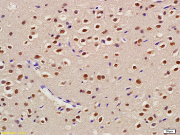 USP22 Rabbit Polyclonal Antibody