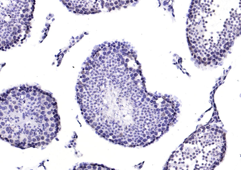 TSSK6 Rabbit Polyclonal Antibody