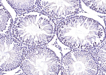 TSSK6 Rabbit Polyclonal Antibody