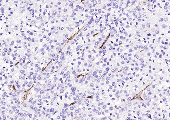 Von Willebrand Factor Rabbit Polyclonal Antibody