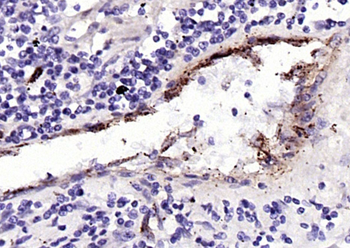 Von Willebrand Factor Rabbit Polyclonal Antibody