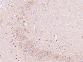 Von Willebrand Factor Rabbit Polyclonal Antibody