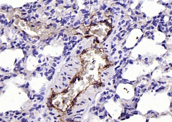 Von Willebrand Factor Rabbit Polyclonal Antibody