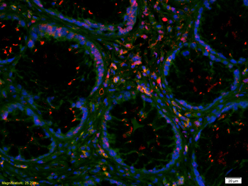 Von Willebrand Factor Rabbit Polyclonal Antibody