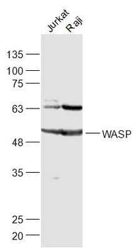 WASP Rabbit Polyclonal Antibody