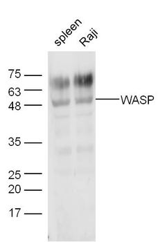WASP Rabbit Polyclonal Antibody