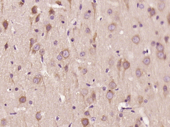 WDR91 Rabbit Polyclonal Antibody