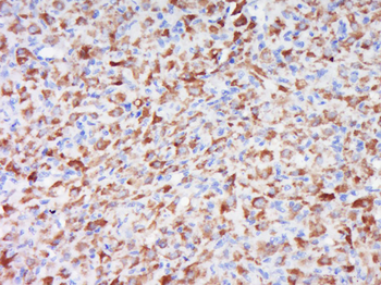 WRB Rabbit Polyclonal Antibody