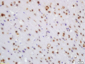 WRB Rabbit Polyclonal Antibody