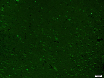 ZAK Rabbit Polyclonal Antibody