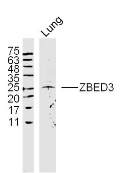 ZBED3 Rabbit Polyclonal Antibody