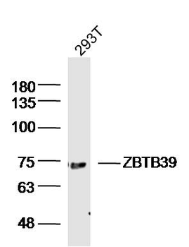 ZBTB39 Rabbit Polyclonal Antibody