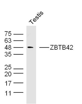 ZBTB42 Rabbit Polyclonal Antibody