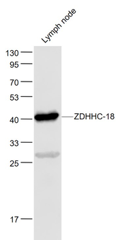 ZDHHC-18 Rabbit Polyclonal Antibody