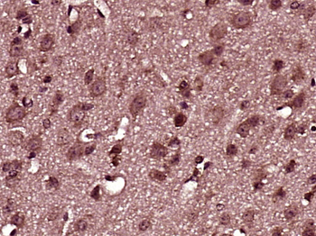 Zic1 Rabbit Polyclonal Antibody