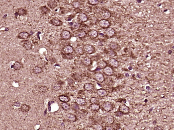 Zic1 Rabbit Polyclonal Antibody