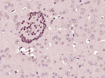 ZIC3 Rabbit Polyclonal Antibody