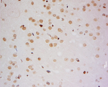 ZMYM2 Rabbit Polyclonal Antibody