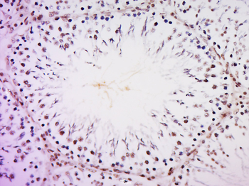 ZMYM2 Rabbit Polyclonal Antibody