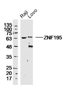 ZNF195 Rabbit Polyclonal Antibody