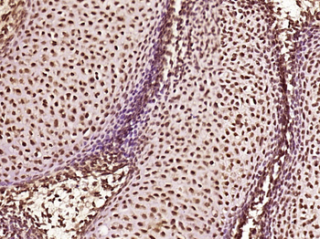 ZNF312 Rabbit Polyclonal Antibody