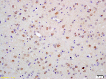 ZNF312 Rabbit Polyclonal Antibody