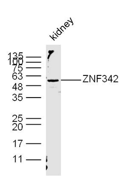 ZNF342 Rabbit Polyclonal Antibody