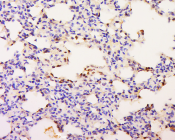 ZNF342 Rabbit Polyclonal Antibody