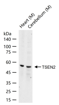 TSEN2 Rabbit Polyclonal Antibody