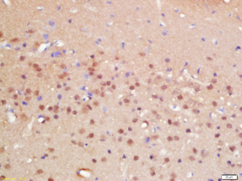 ZNF423 Rabbit Polyclonal Antibody