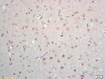 ZNF423 Rabbit Polyclonal Antibody