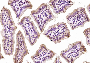 ZNF503 Rabbit Polyclonal Antibody