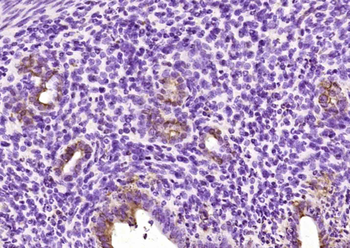 ZNF503 Rabbit Polyclonal Antibody