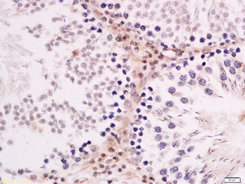 ZNF516 Rabbit Polyclonal Antibody