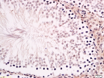 ZNF516 Rabbit Polyclonal Antibody