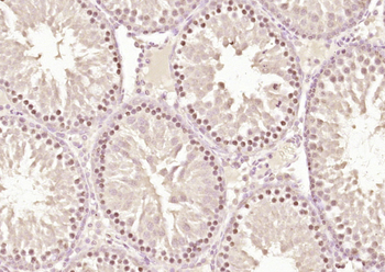 ZNF575 Rabbit Polyclonal Antibody