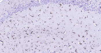 Mouse GFAP Ready-To-Use IHC Kit