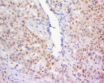 ZNF619 Rabbit Polyclonal Antibody
