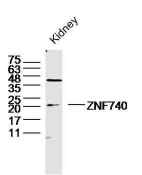 ZNF740 Rabbit Polyclonal Antibody