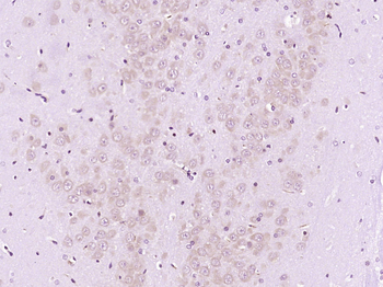 WISP3 Rabbit Polyclonal Antibody
