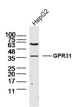 GPR31 Rabbit Polyclonal Antibody