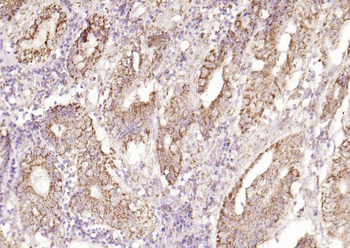 Ecat1 Rabbit Polyclonal Antibody