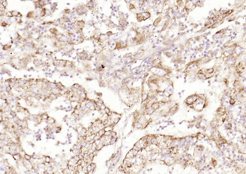 Ecat1 Rabbit Polyclonal Antibody