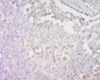CYP2S1 Rabbit Polyclonal Antibody
