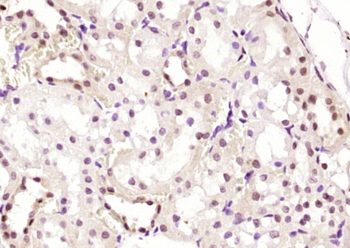 HESX1 Rabbit Polyclonal Antibody