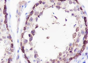 STIP1 Recombinant Rabbit Monoclonal Antibody